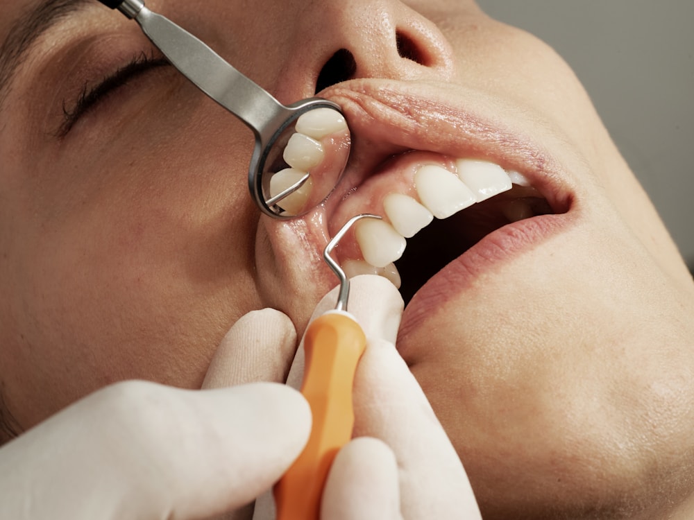 What Are the Essential Vitamins Your Teeth and Gums Need